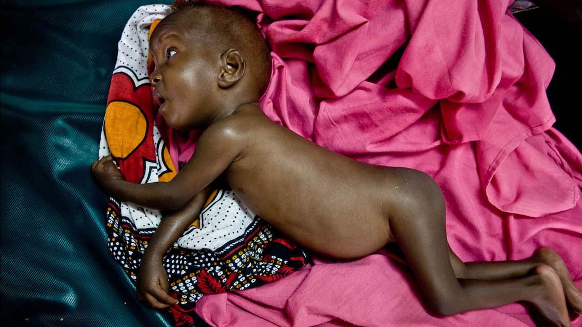 Resultado de imagen para Embarazadas desnutridas darán a luz bebés con alteraciones